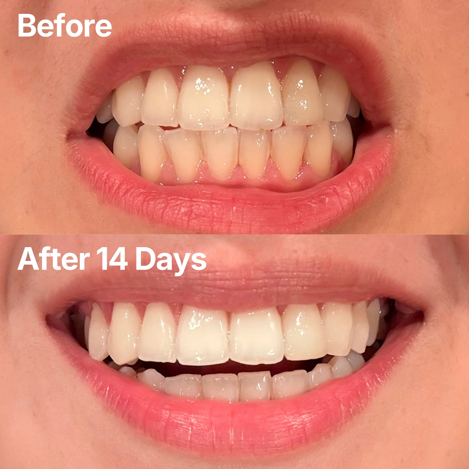 PAP+ Teeth Whitening Powder