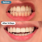 PAP+ Teeth Whitening Powder